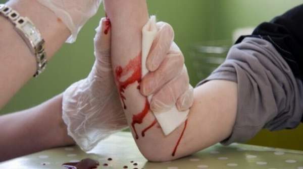 Severe Bleeding - 8 Life Saving Steps | First Aid | Skills Training Group